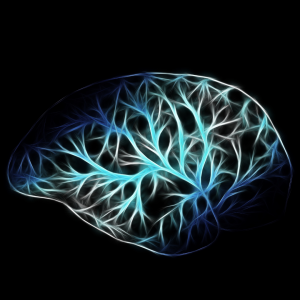Graphic of Arteries in Brain
